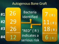 autogenous bone graft