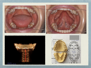 clinical dental photos