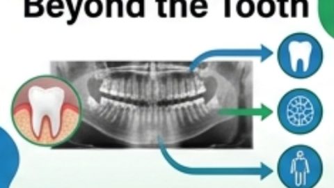 Beyond the Tooth-Mapping Oral-Systemic Clinical Patterns: From Neurology to Tooth-Organ Relationships CE - December 12, 2026