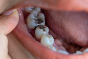 Biological dentistry