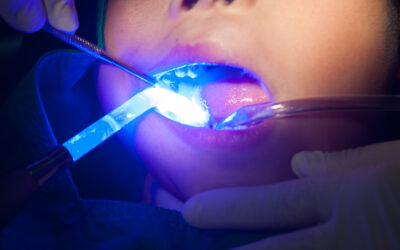 Why More Dental Professionals Are Turning to Ozone Therapy