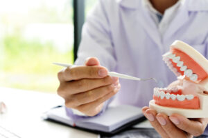 Root Canals